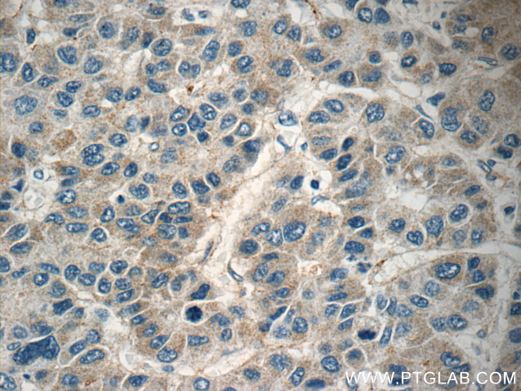 HEBP1 Polyclonal antibody