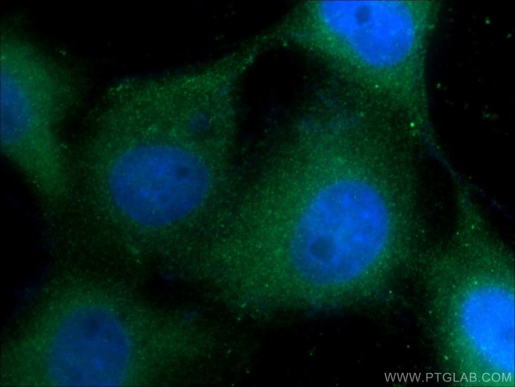 Cytokeratin 1-specific Polyclonal antibody