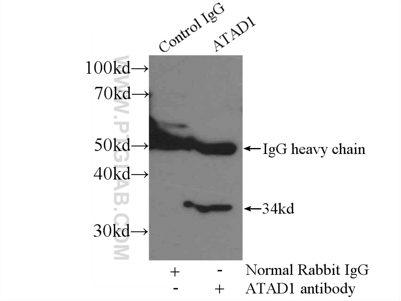 ATAD1 Polyclonal antibody