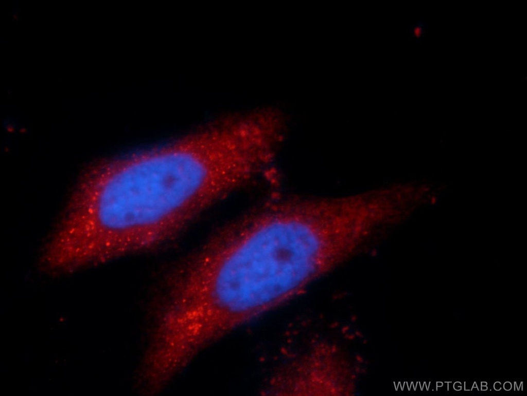 SPAG16 Polyclonal antibody