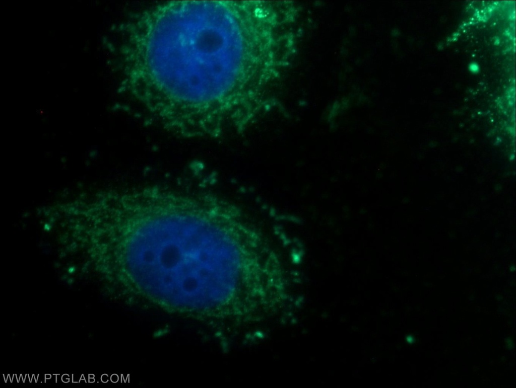 MTCH2 Polyclonal antibody