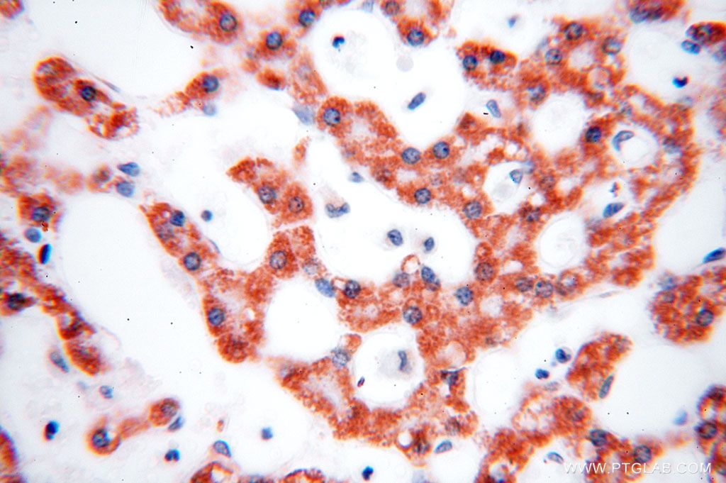 HMGCL Polyclonal antibody