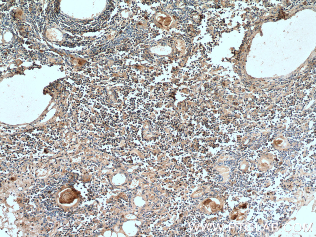 UNC13D/Munc13-4 Polyclonal antibody