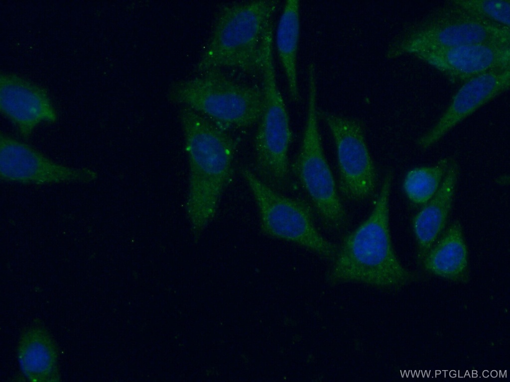 PIGT Polyclonal antibody