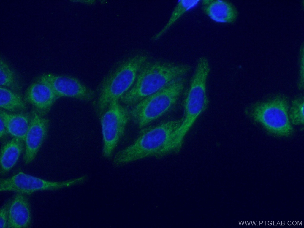 PROS1 Polyclonal antibody