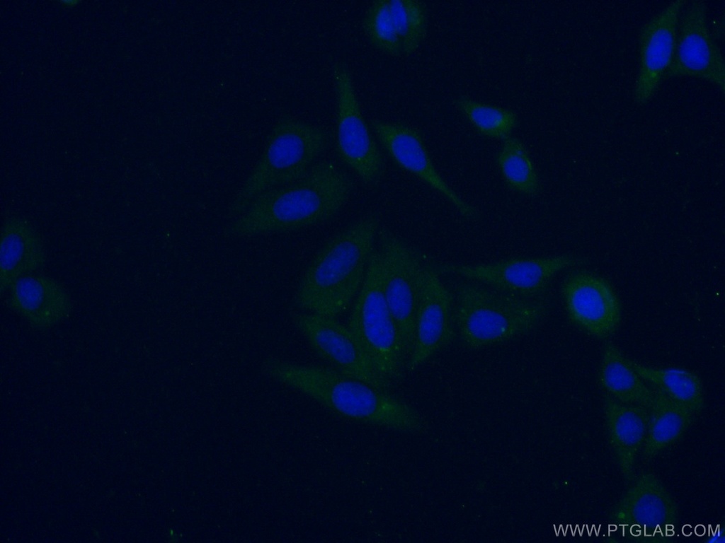 KRCC1 Polyclonal antibody
