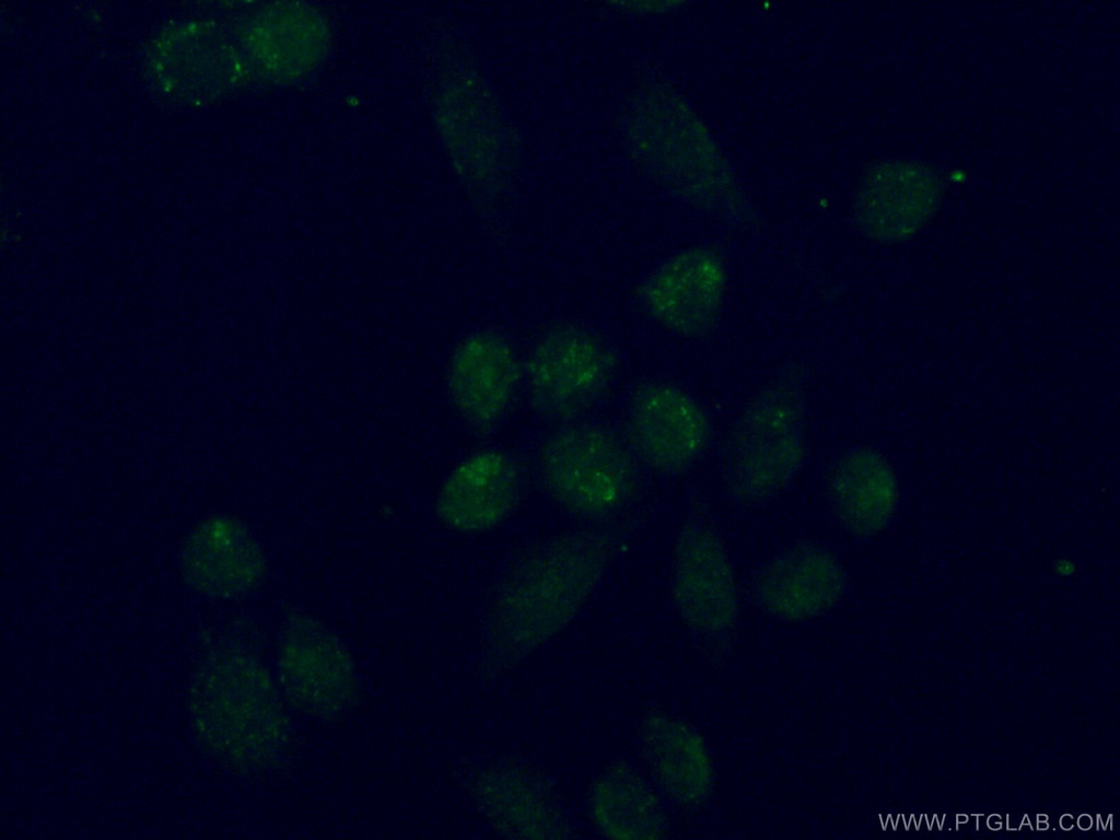 TBX2 Polyclonal antibody
