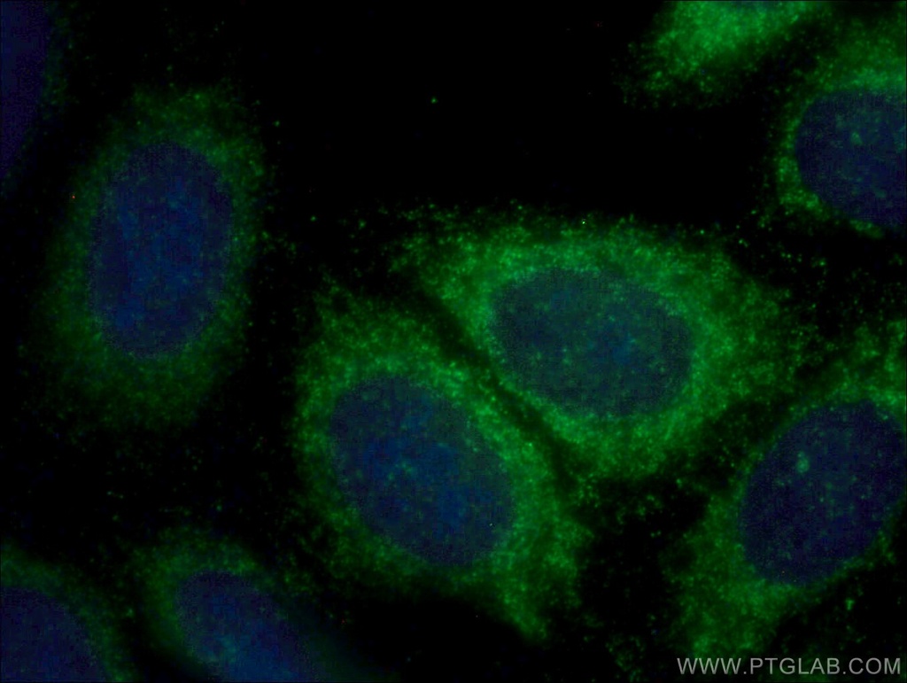 AP1B1 Polyclonal antibody