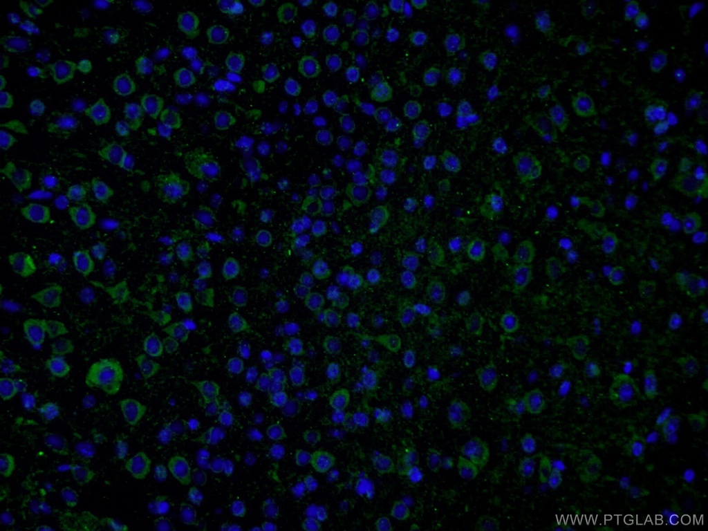 PHYHIPL Polyclonal antibody