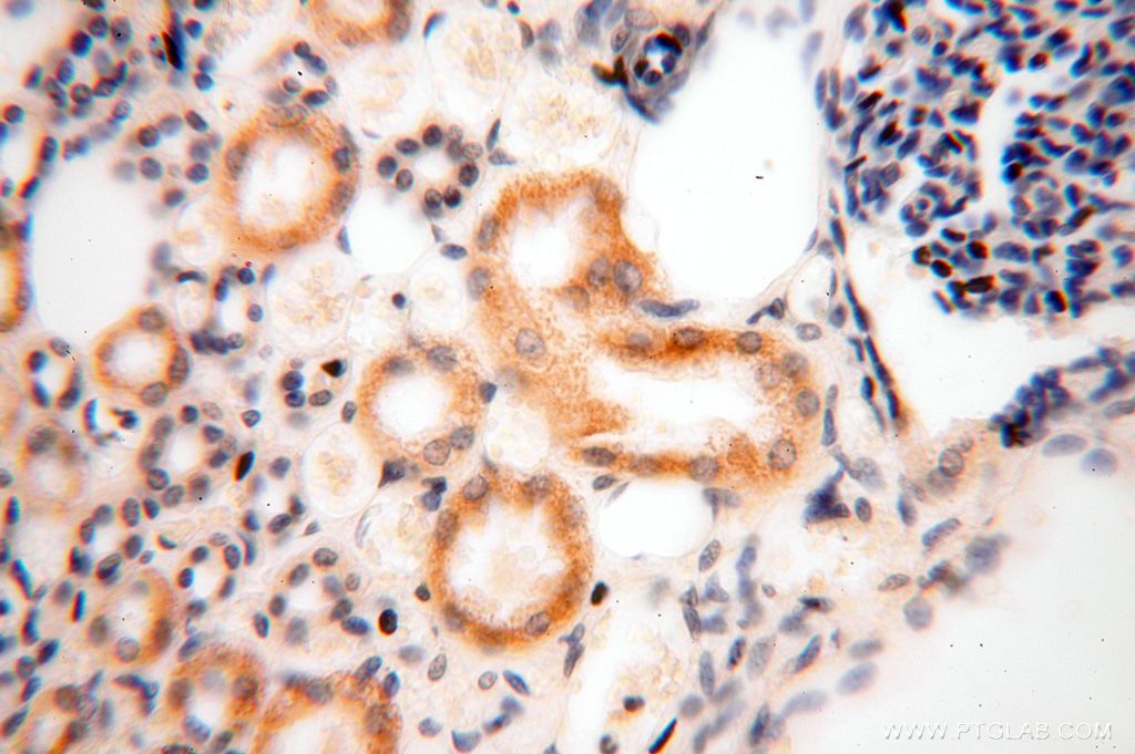 GALNT14 Polyclonal antibody