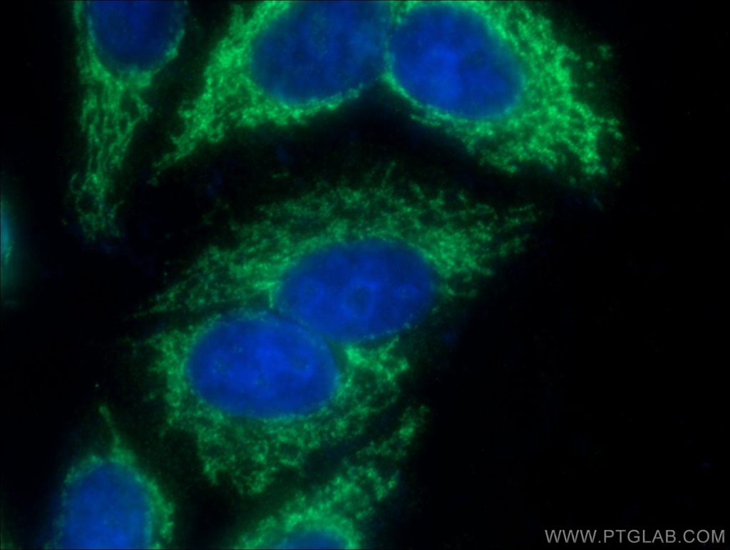 GFM2 Polyclonal antibody