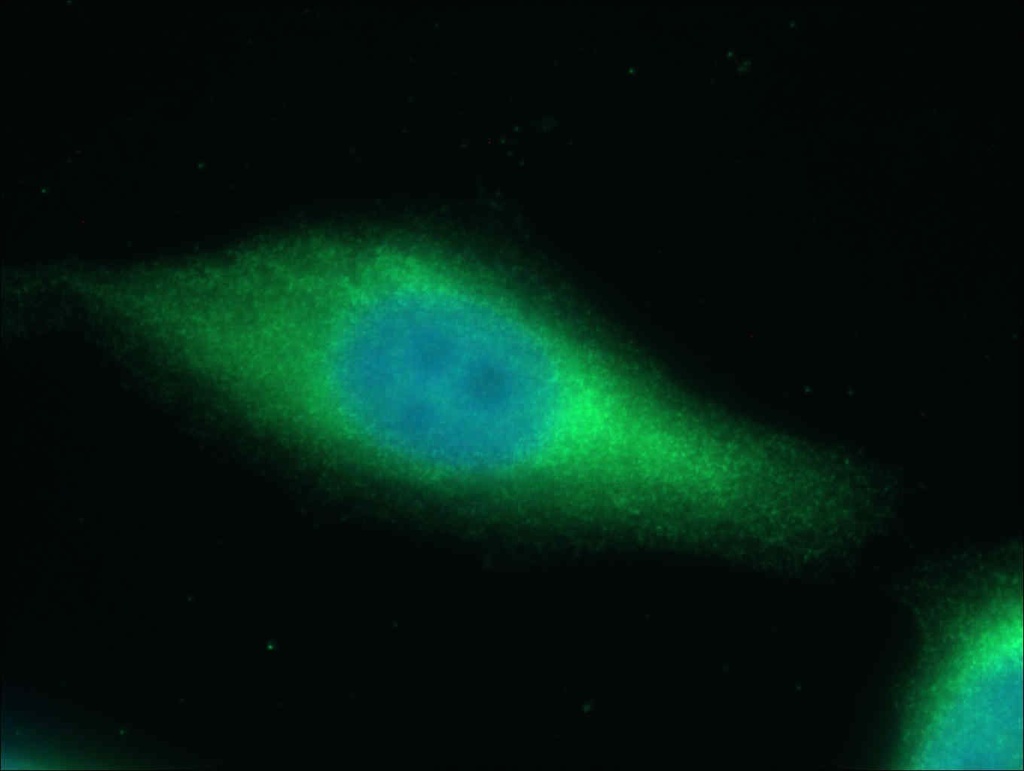 SAPS3 Polyclonal antibody