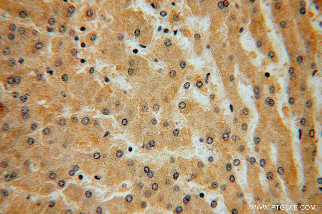 KLHL3 Polyclonal antibody