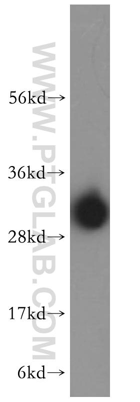 MTERF Polyclonal antibody