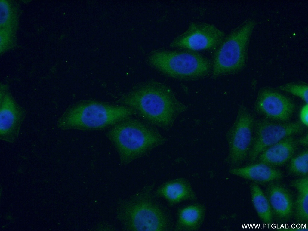 Connexin-26 Polyclonal antibody