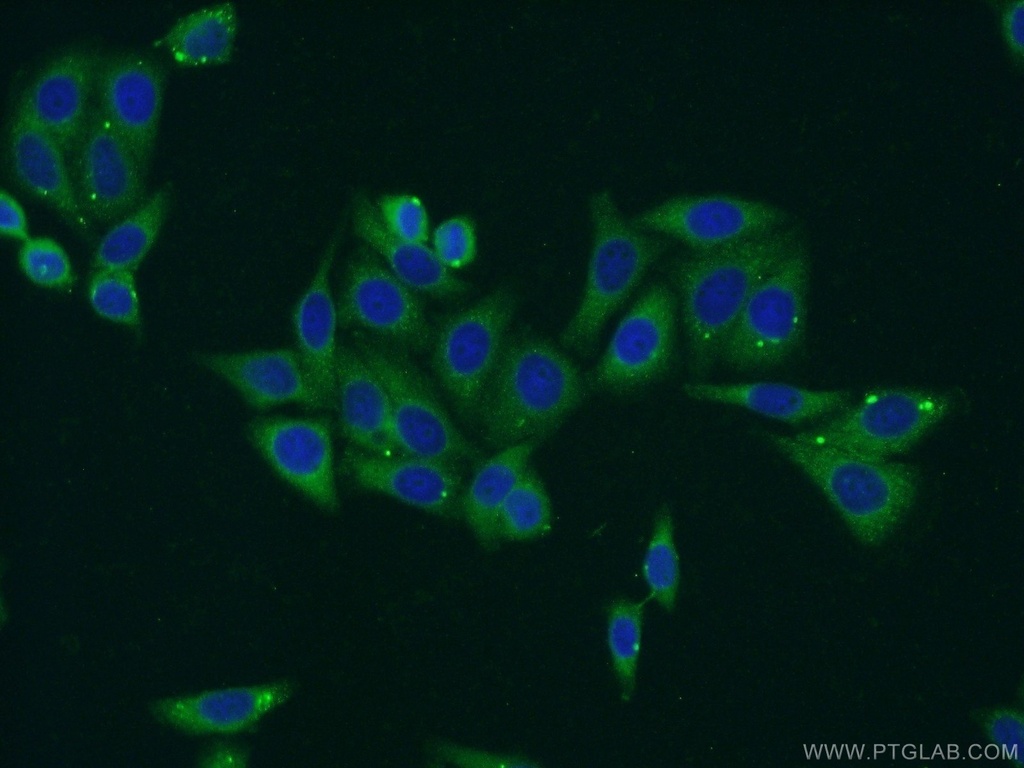 RPS5 Polyclonal antibody