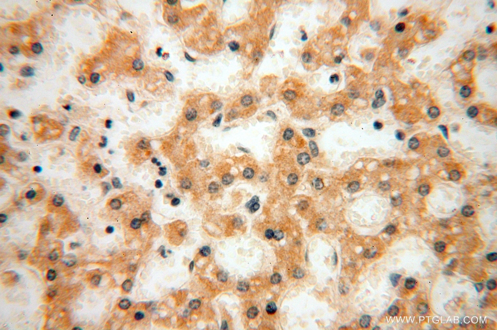 MRPL21 Polyclonal antibody