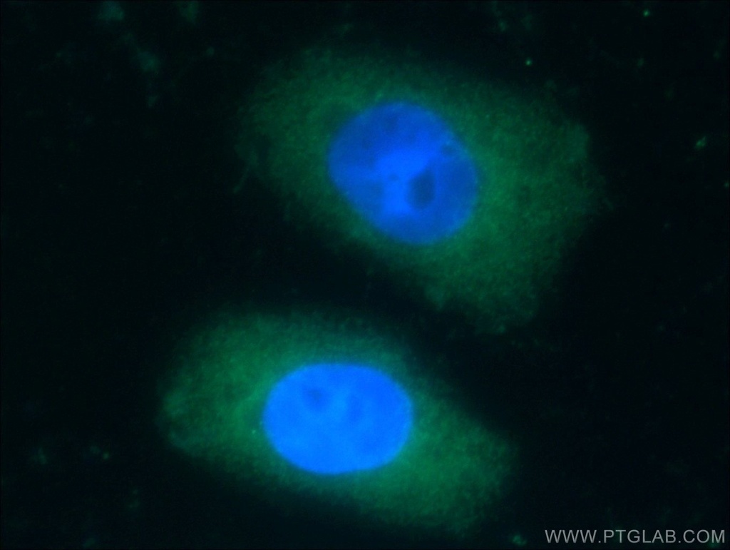 KCNJ3 Polyclonal antibody