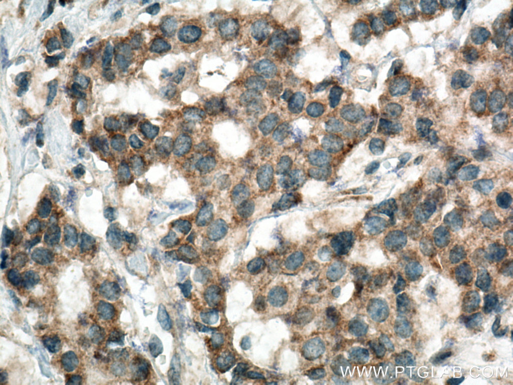 HSDL1 Polyclonal antibody