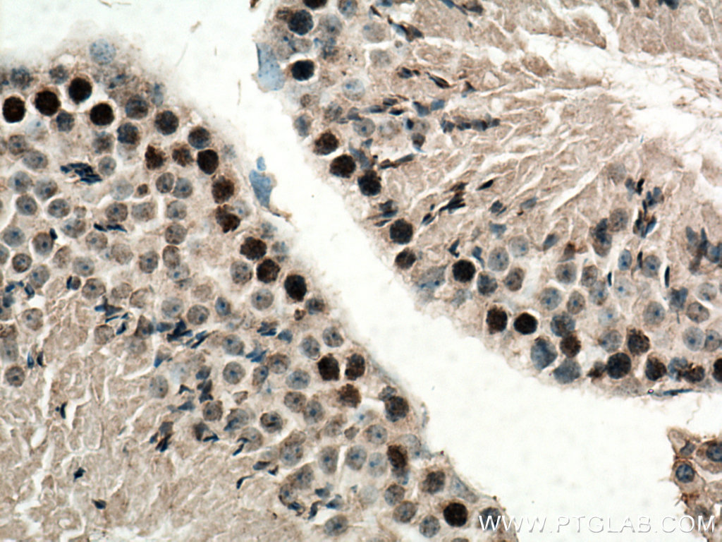 SPATA22 Polyclonal antibody