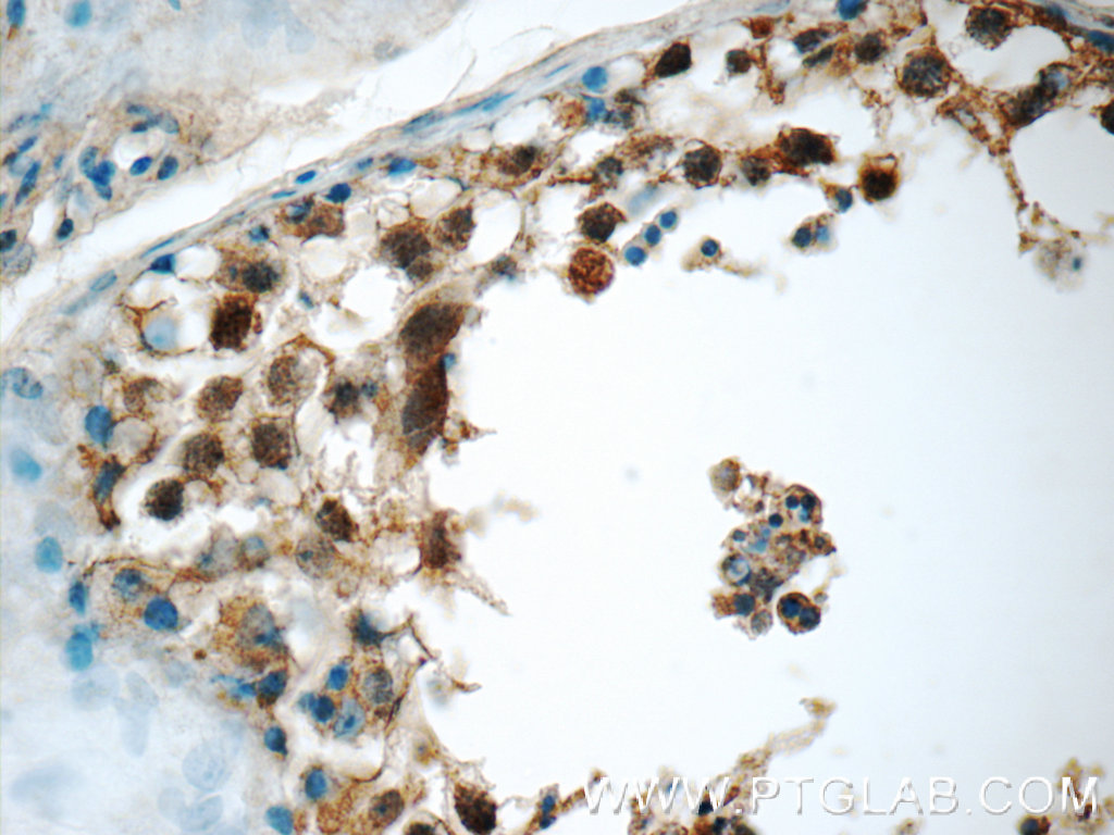 SCAPER Polyclonal antibody