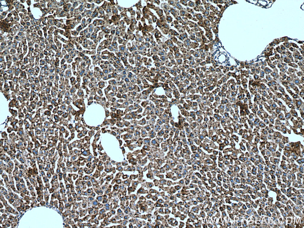 METTL7B Polyclonal antibody