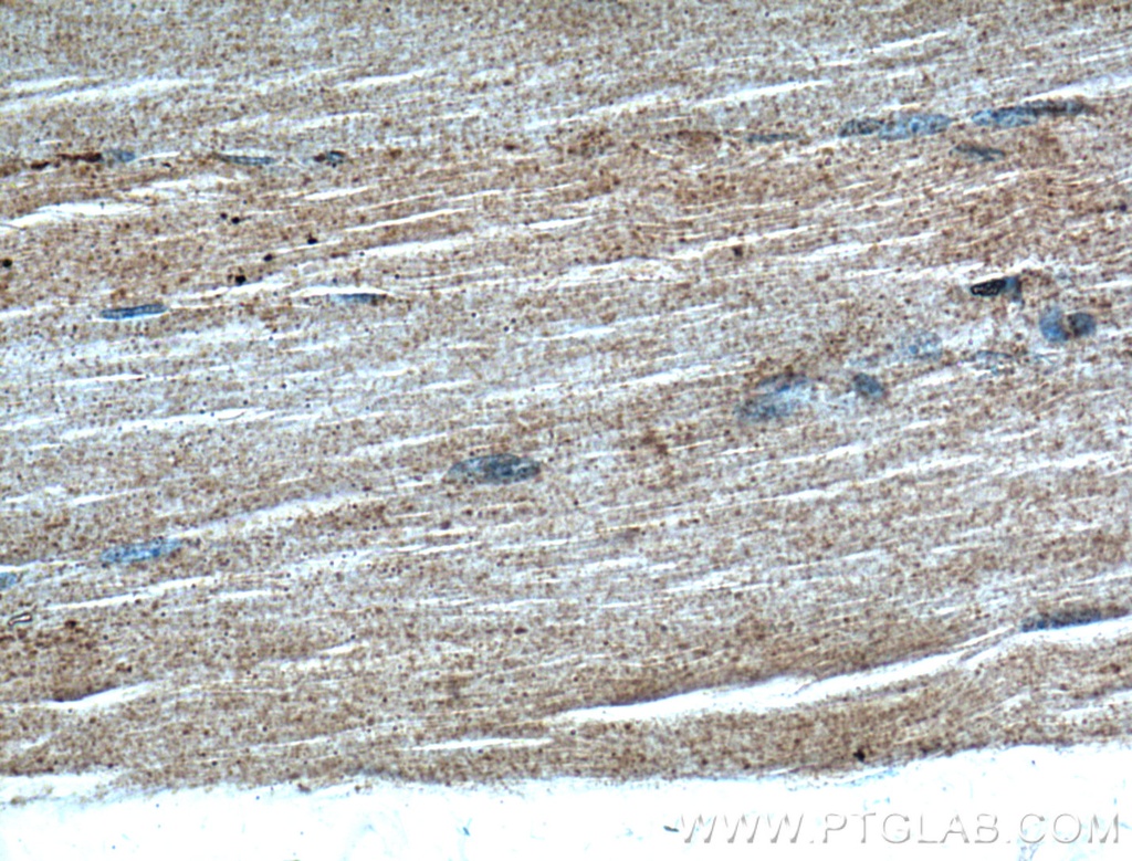 GRK5 Polyclonal antibody