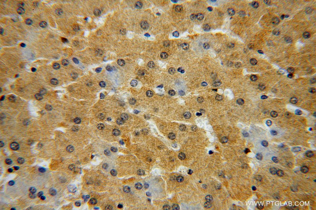 GALT Polyclonal antibody