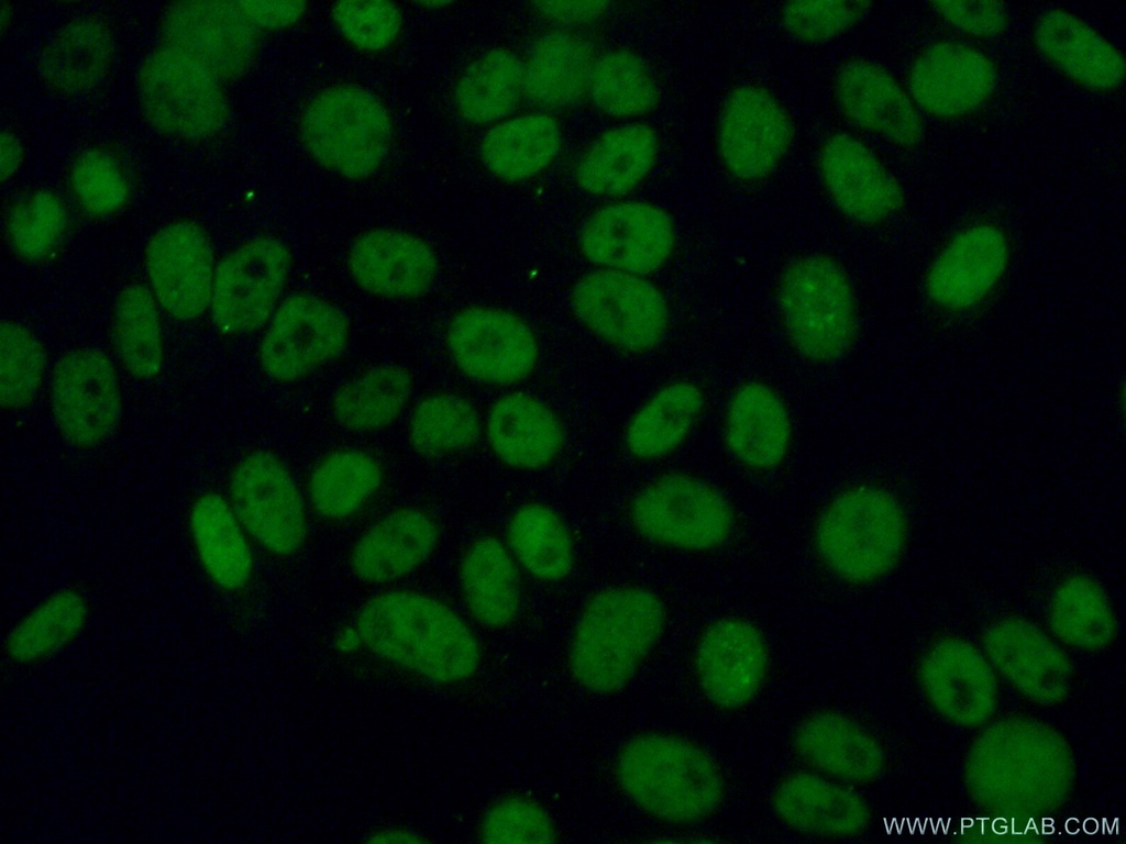 CHAF1A Polyclonal antibody