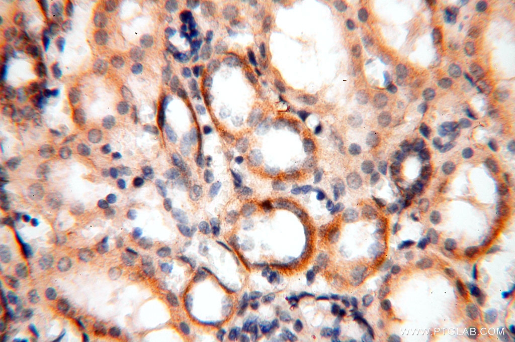 MRPS11 Polyclonal antibody