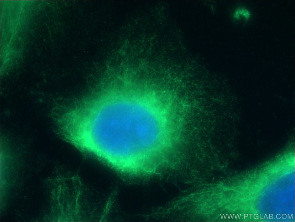 CLIP4 Polyclonal antibody