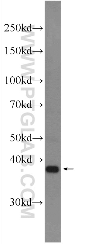 DPPA4 Polyclonal antibody