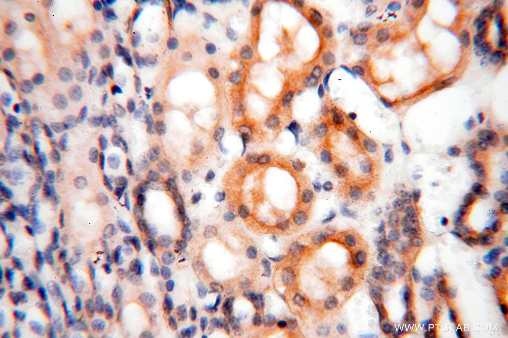 ROGDI Polyclonal antibody