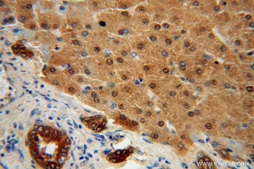 STARD10 Polyclonal antibody