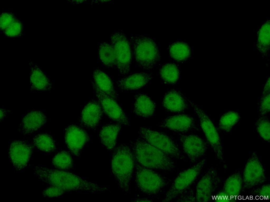 GTF2IRD1 Polyclonal antibody