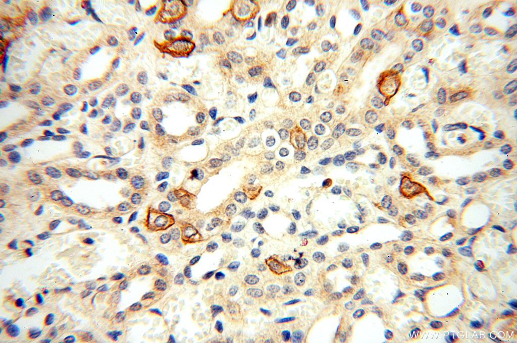 TEKT4 Polyclonal antibody