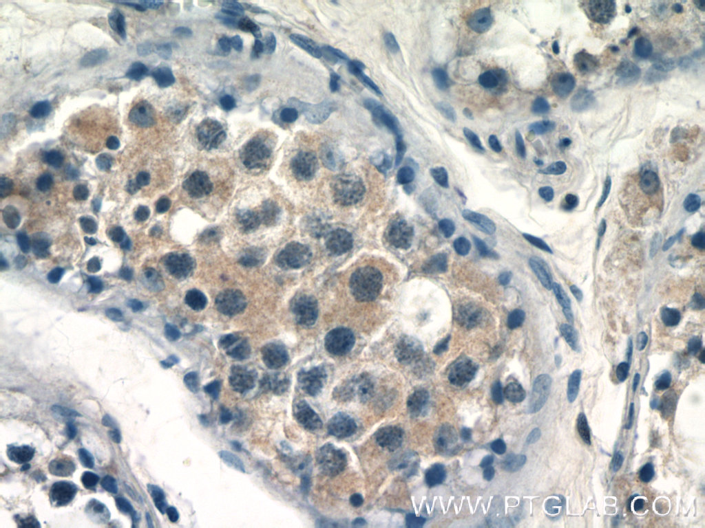 CALR3 Polyclonal antibody