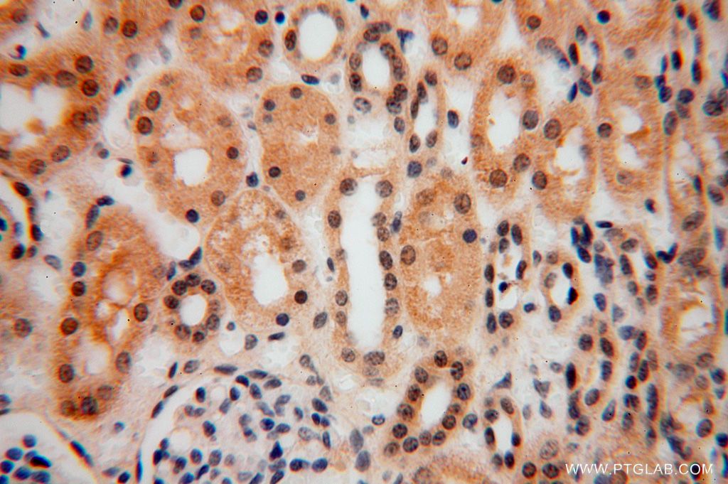 SLFNL1 Polyclonal antibody