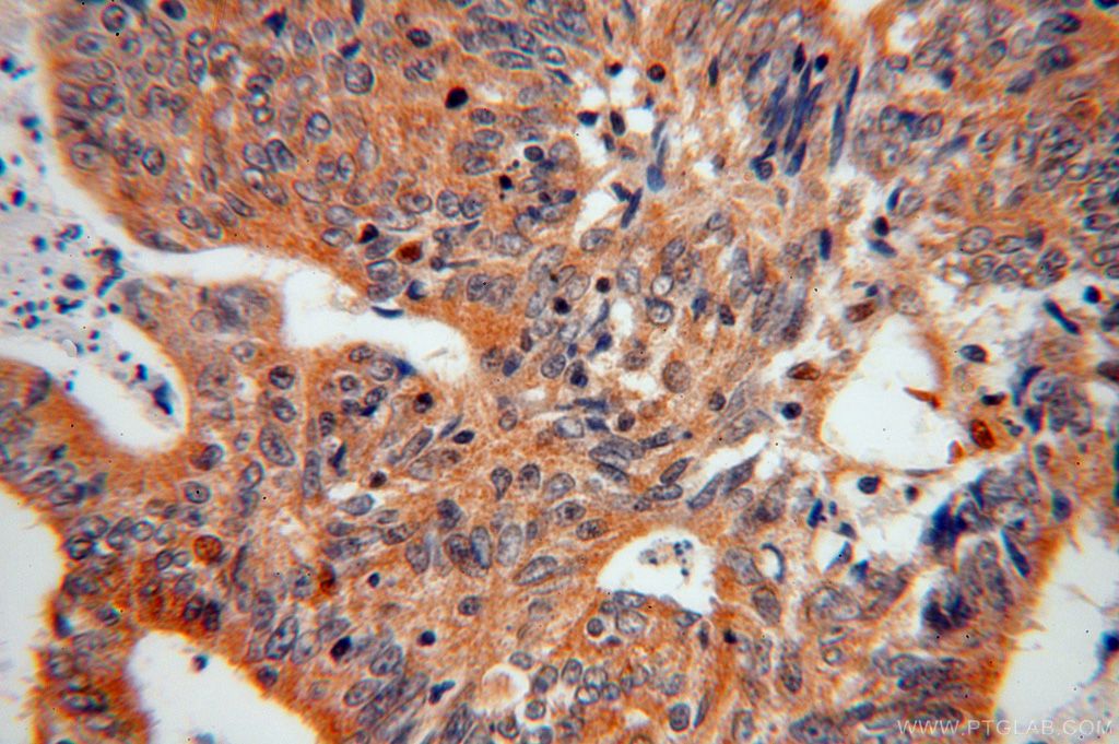 EIF5A1/EIF5A2 Polyclonal antibody