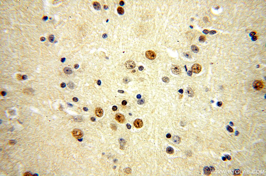 ZNF18 Polyclonal antibody