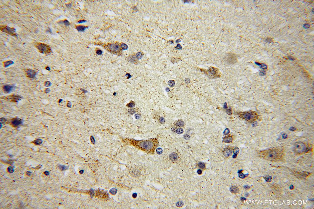 AUH Polyclonal antibody