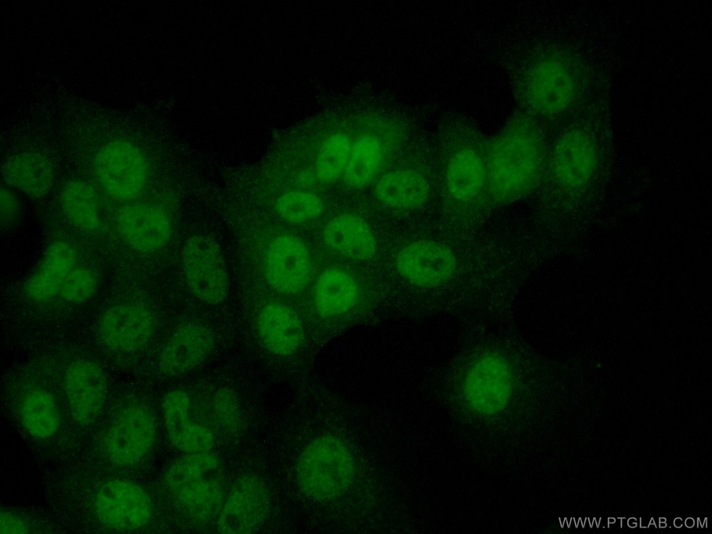 PDPK1 Polyclonal antibody