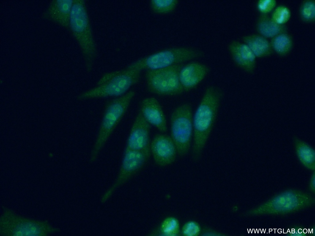 DDX27 Polyclonal antibody