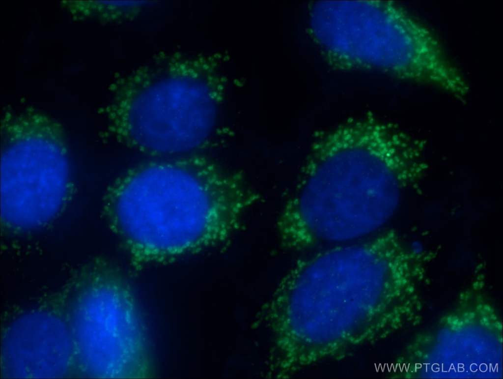 LARS2 Polyclonal antibody