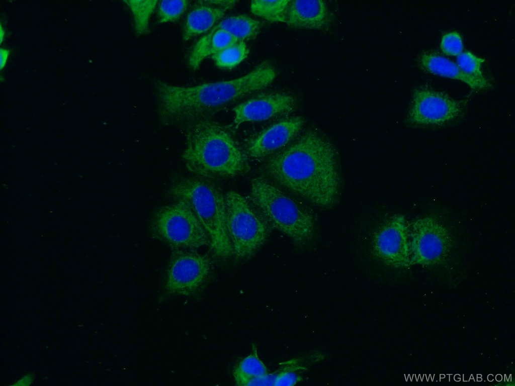 RUNDC3B Polyclonal antibody