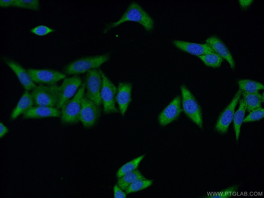 UPF3A Polyclonal antibody