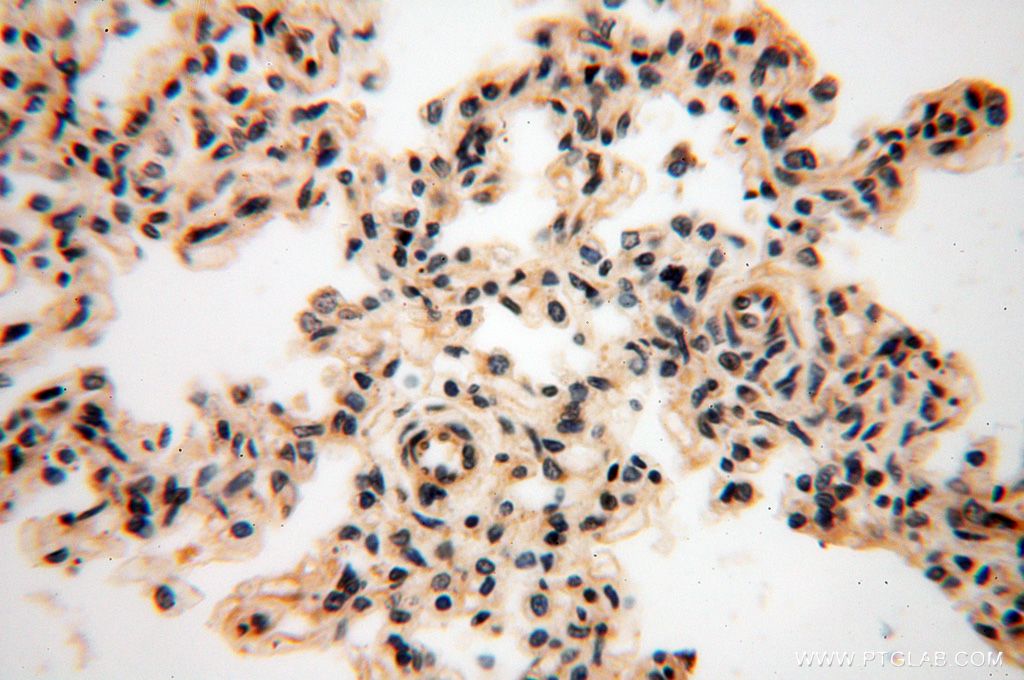 GALNTL5 Polyclonal antibody