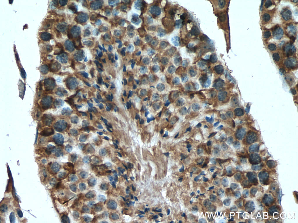PDHA2 Polyclonal antibody