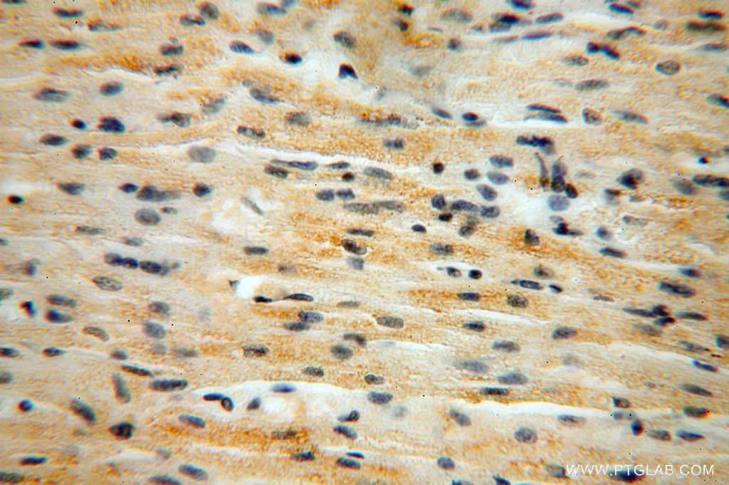 B3GALNT2 Polyclonal antibody