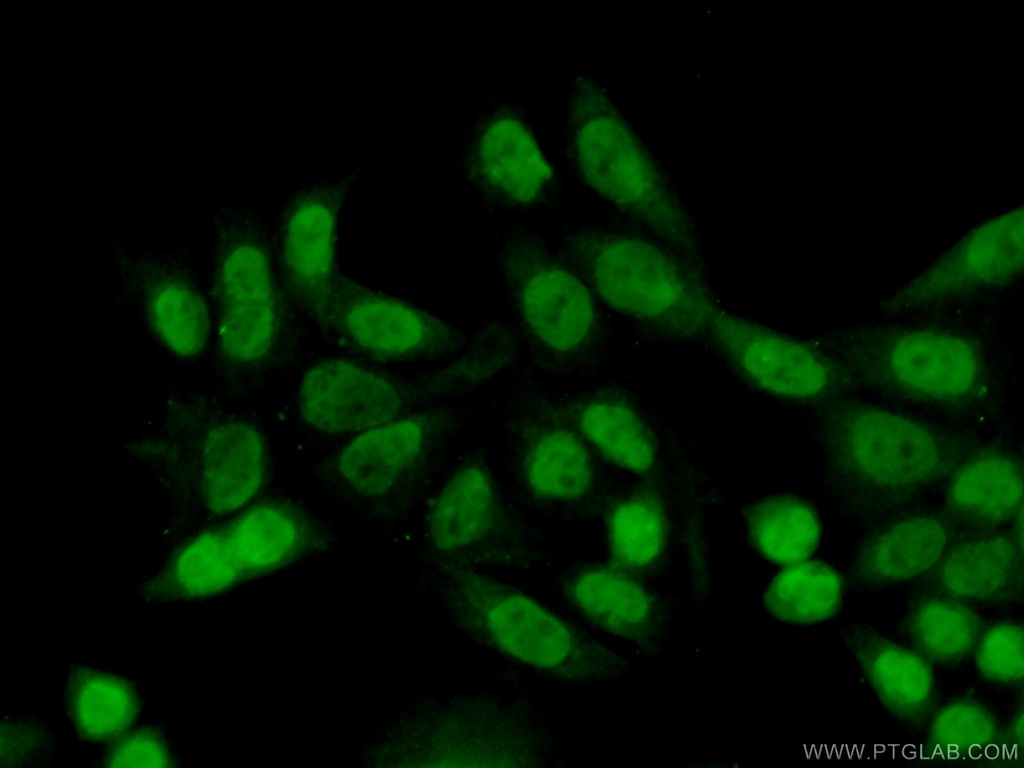 TCEA3 Polyclonal antibody